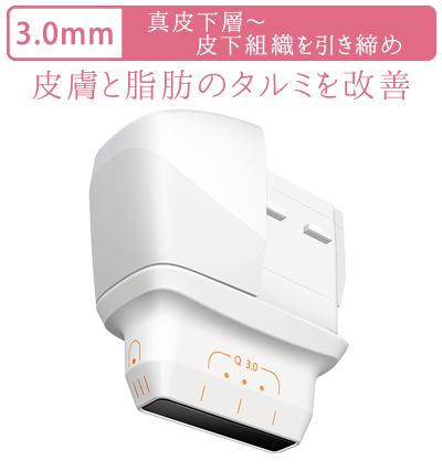 ウルトラセル Qプラス